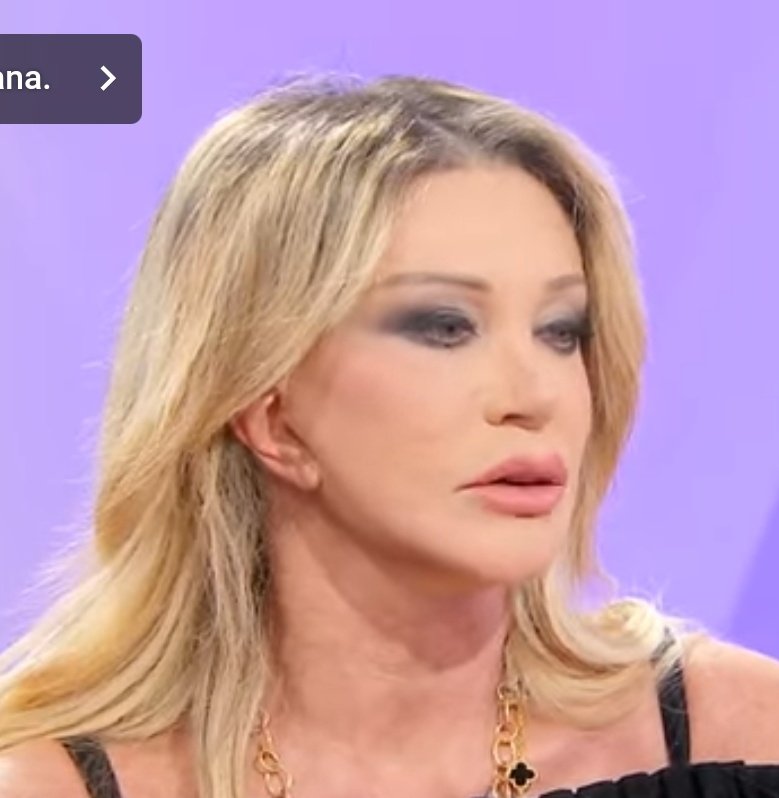 Se il patriarcato non si combatte facendo vedere il culo #Elodie (<a href="/elodiesfamily/">Elodie's Family</a> ) penso che nemmeno facendo l'ennesimo lifting con le orecchie attaccate alla mandibola #paolaferrari