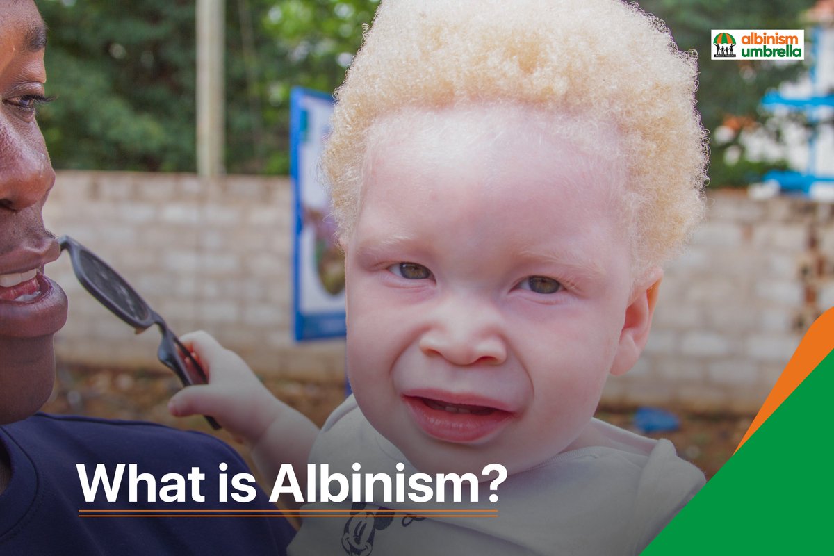 albinismumbrell's tweet photo. As sensitization remains key, our question comes to you the general public.
What do you know about albinism?
Or
Who is a person with albinism?
#AlbinismFacts https://t.co/ZPiQdTfp57