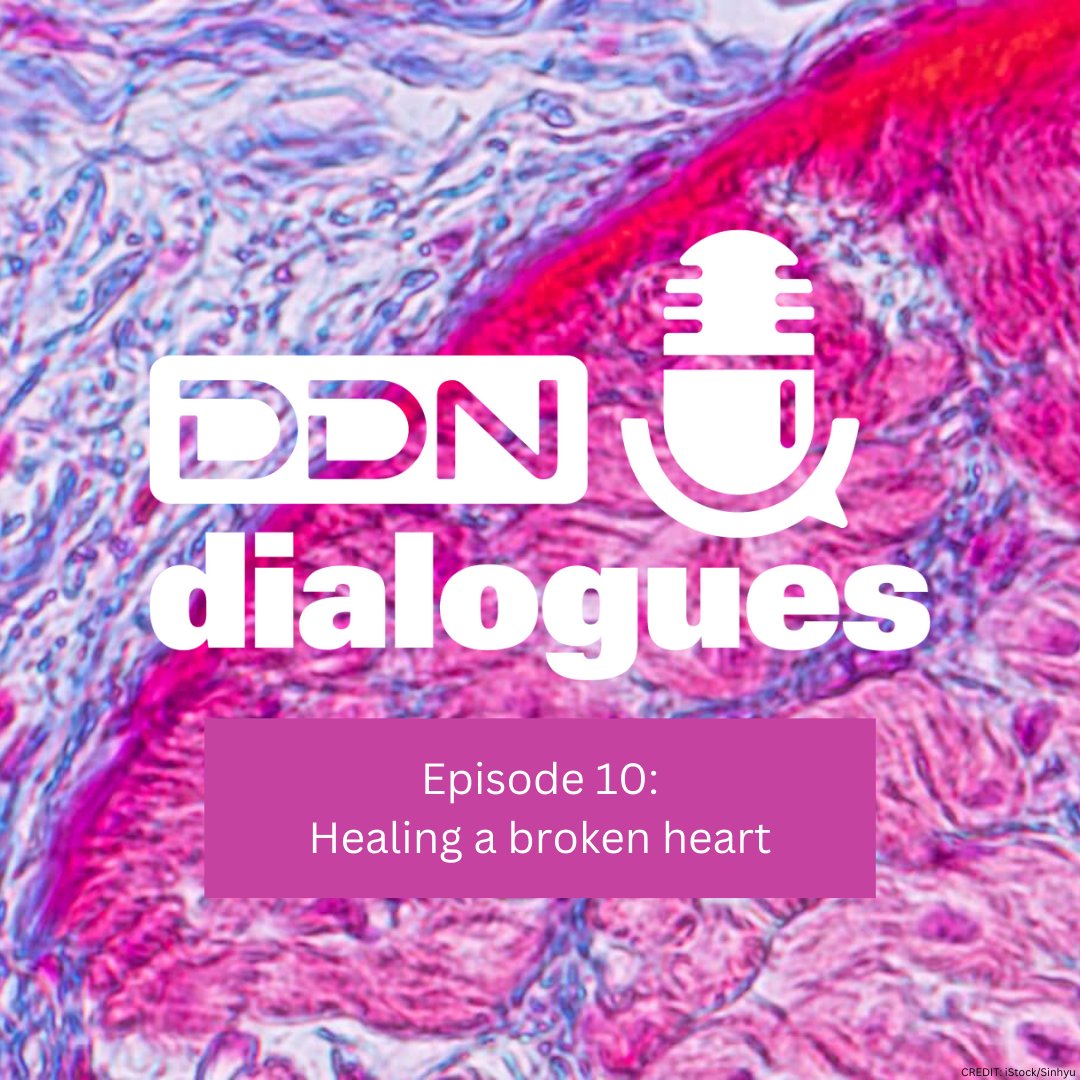 Drug Discovery News (@drugdiscovnews) on Twitter photo Heart muscle can’t regrow after a heart attack.
But researchers like <a href="/heshamasadek/">Hesham Sadek</a>, Jens Tank, Charles Murry, and Jim Martin are getting closer than ever before.
Hear about the latest progress in this new DDN Dialogues podcast with <a href="/allisonpwhitten/">Allison Whitten, PhD</a>: ow.ly/U7wW50SXPii Heart muscle can’t regrow after a heart attack.
But researchers like <a href="/heshamasadek/">Hesham Sadek</a>, Jens Tank, Charles Murry, and Jim Martin are getting closer than ever before.
Hear about the latest progress in this new DDN Dialogues podcast with <a href="/allisonpwhitten/">Allison Whitten, PhD</a>: ow.ly/U7wW50SXPii