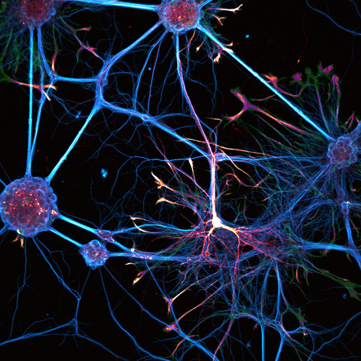 BIC (@bic_bordeaux) on Twitter photo #ImageOfTheMonth
This image was acquired by J.Angibaud <a href="/iins_bordeaux/">Interdisciplinary Institute for Neuroscience 🧠</a>. Neurons and astrocytes are cultured on a soft polyacrylamide hydrogel. Neurons are labeled for MAP-2 protein (blue), astrocytes for GFAP protein (red) and transfected neurons show GFP expression (green). #ImageOfTheMonth
This image was acquired by J.Angibaud <a href="/iins_bordeaux/">Interdisciplinary Institute for Neuroscience 🧠</a>. Neurons and astrocytes are cultured on a soft polyacrylamide hydrogel. Neurons are labeled for MAP-2 protein (blue), astrocytes for GFAP protein (red) and transfected neurons show GFP expression (green).