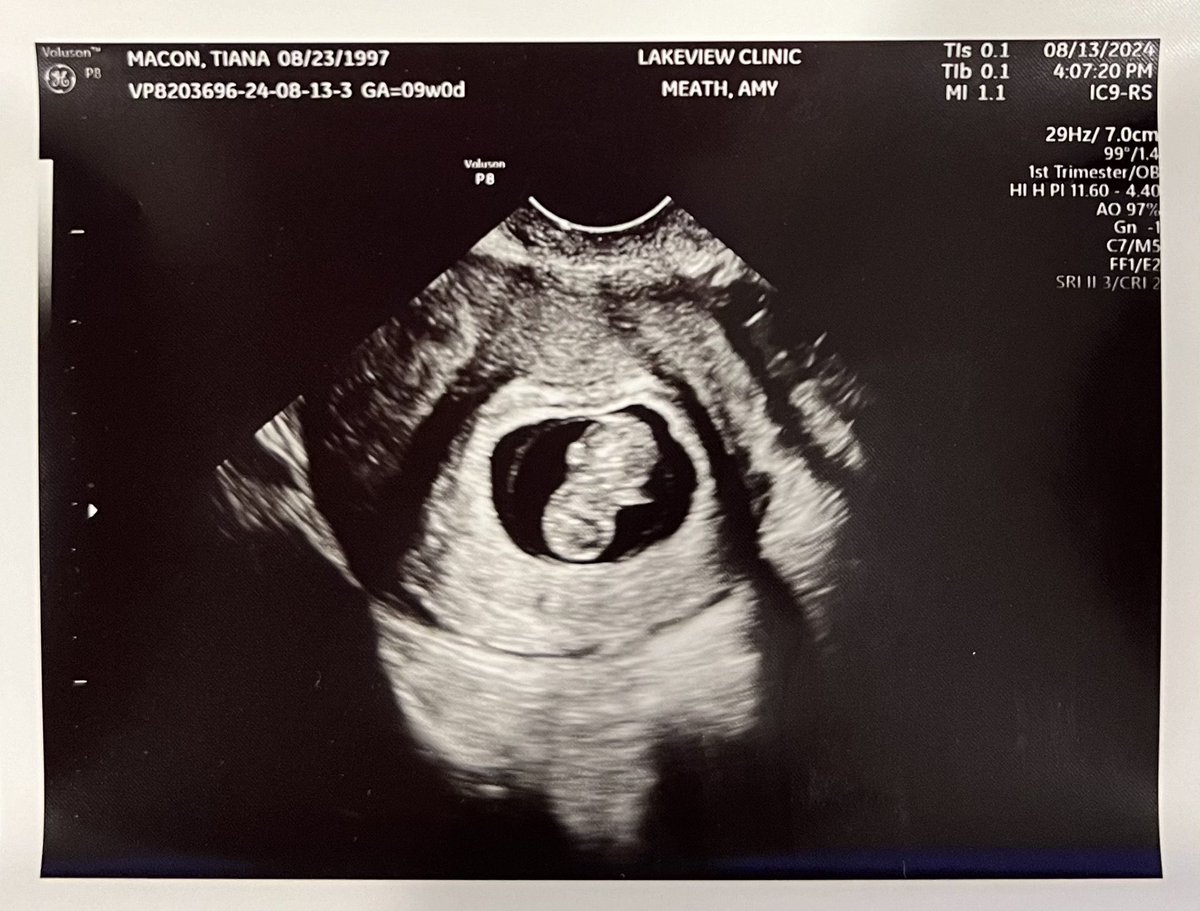 SlumChronic's tweet photo. What an amazing summer Tiana and I have had! From moving into our new home, getting engaged, and now a new addition to our little family! 🥰
@HamburgerHooker https://t.co/6GJs0s9JXd