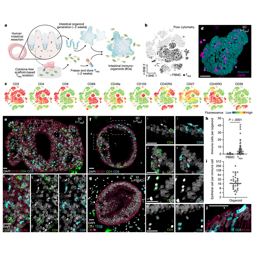 A paper published in <a href="/Nature/">nature</a> presents an intestinal immuno-organoid model with tissue-resident memory T cells. This model offers a closer look at gut immune interactions and sheds light on inflammation caused by cancer therapies. go.nature.com/3Ap3BT7