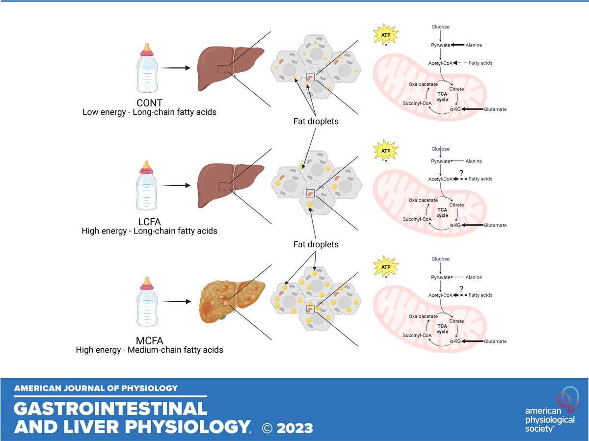 ajpgi's tweet photo. 🔓#SuggestedRead "Feeding medium-chain fatty acid-rich formula causes #liver #steatosis and alters hepatic metabolism in neonatal pigs" by Samuel D. Gerrard et al.
🔗https://t.co/CcWU4xBd9o
#LiverTwitter #MediumChainFattyAcids #LongChainFattyAcids https://t.co/pp8joXKatJ