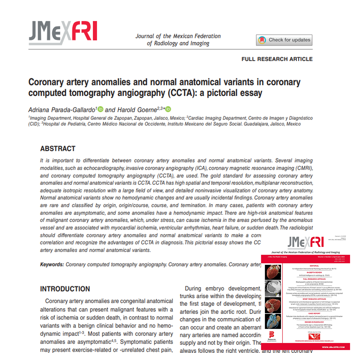 Coronary artery anomalies and normal anatomical variants in coronary computed tomography angiography (CCTA): a pictorial essay
Journal of the Mexican Federation of Radiology and Imaging
2024 | Journal article
#YesCCT #WhyCMR #cardiovascular #radiology #cardiology