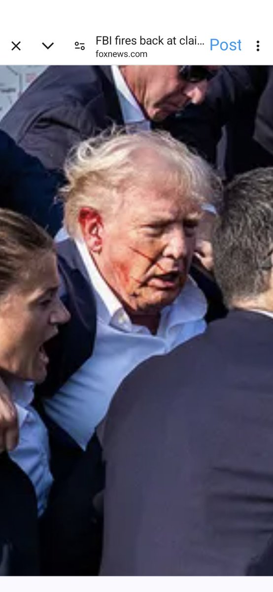 organicoren's tweet image. This is the first time I've seen this angle. I don't see anything that would need a head tampon. I don't see any wounds. #TrumpAssasinationAttempt #TrumpIsALaughingStock #TrumpPedoFiles