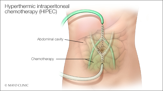 Mayo Clinic Comprehensive Cancer Center tweet media