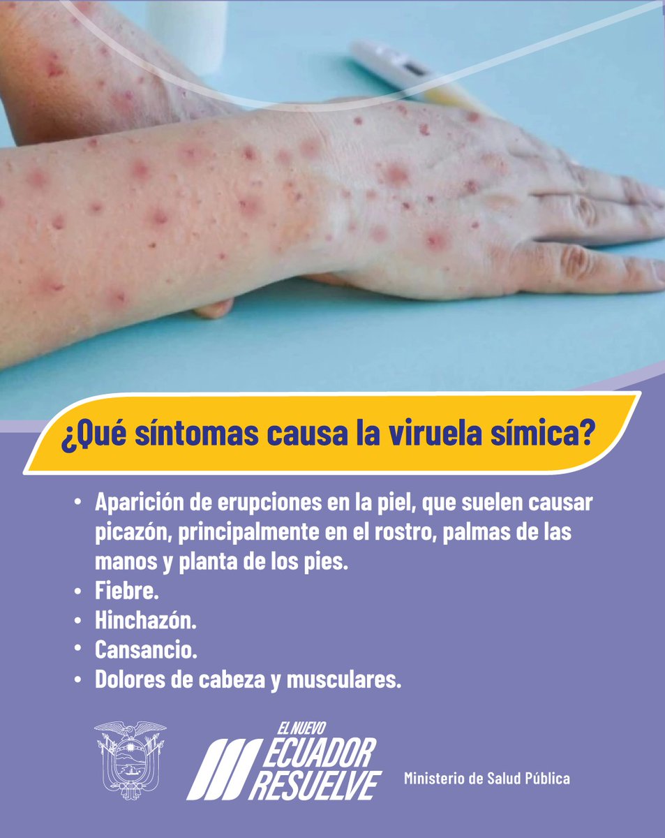 Salud_Ec's tweet photo. Estemos atentos a la #ViruelaSímica ‼️
Acuda al centro de salud🏥 más cercano, en caso de presentar los síntomas relacionados a la viruela símica y mantenerse en casa si se tiene un resultado positivo para MPOX. https://t.co/exWcnMSVIP