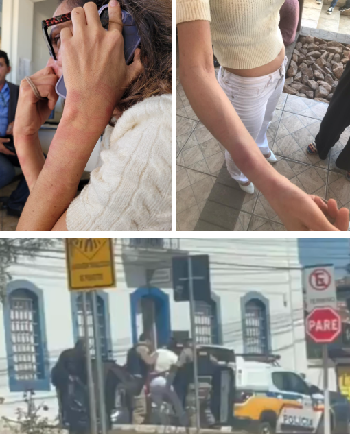 Vereadora Karine Roza (PT), de Serro, MG, mostra o braço machucado, depois q PMs a prenderam, em frente ao Fórum. Ela estava entrando no local, para denunciar omissão da Prefeitura ao MP. Há 10 dias, uma criança, pobre e negra, morreu por falta de ambulância. O prefeito é do PL