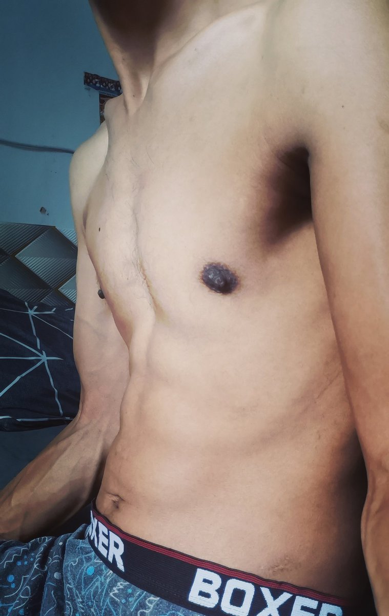 Bdn tk cantik tk apa.
Yg penting kesihatan kena dijaga.