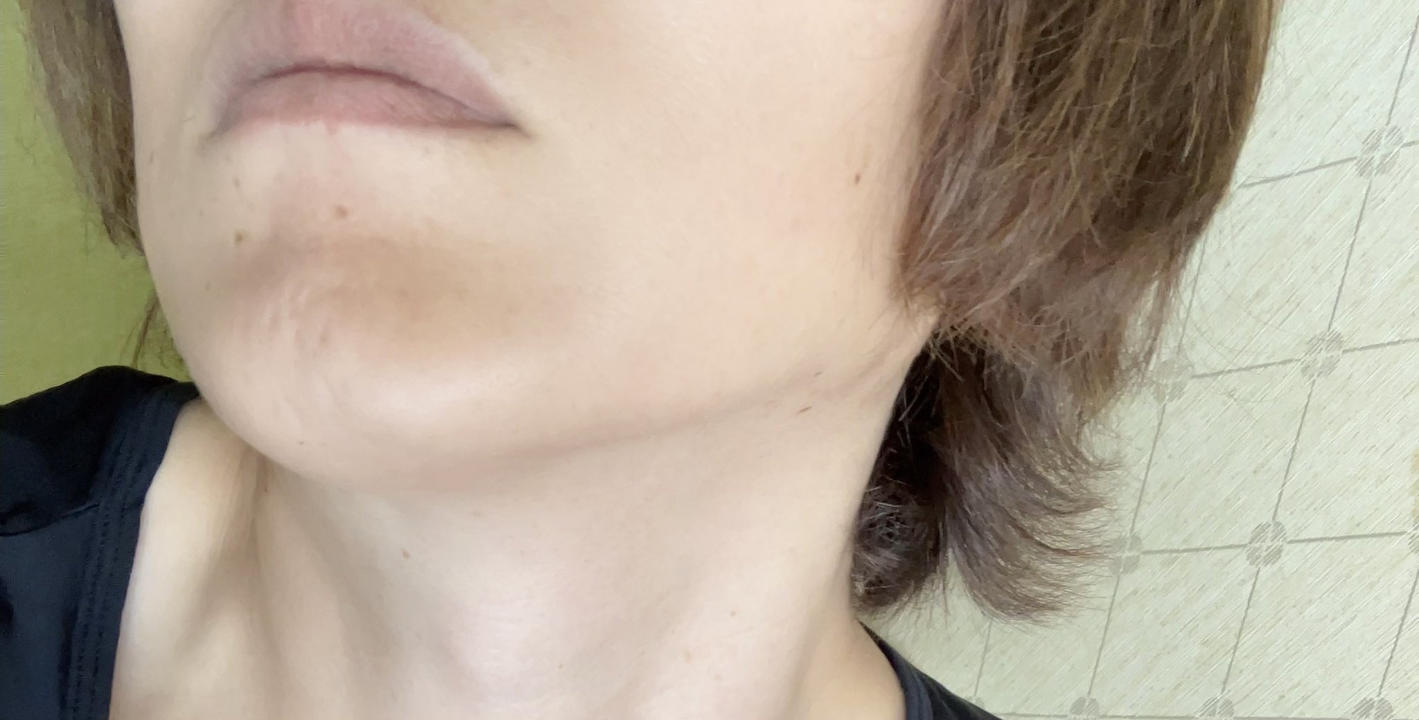 ケノン - Search / X