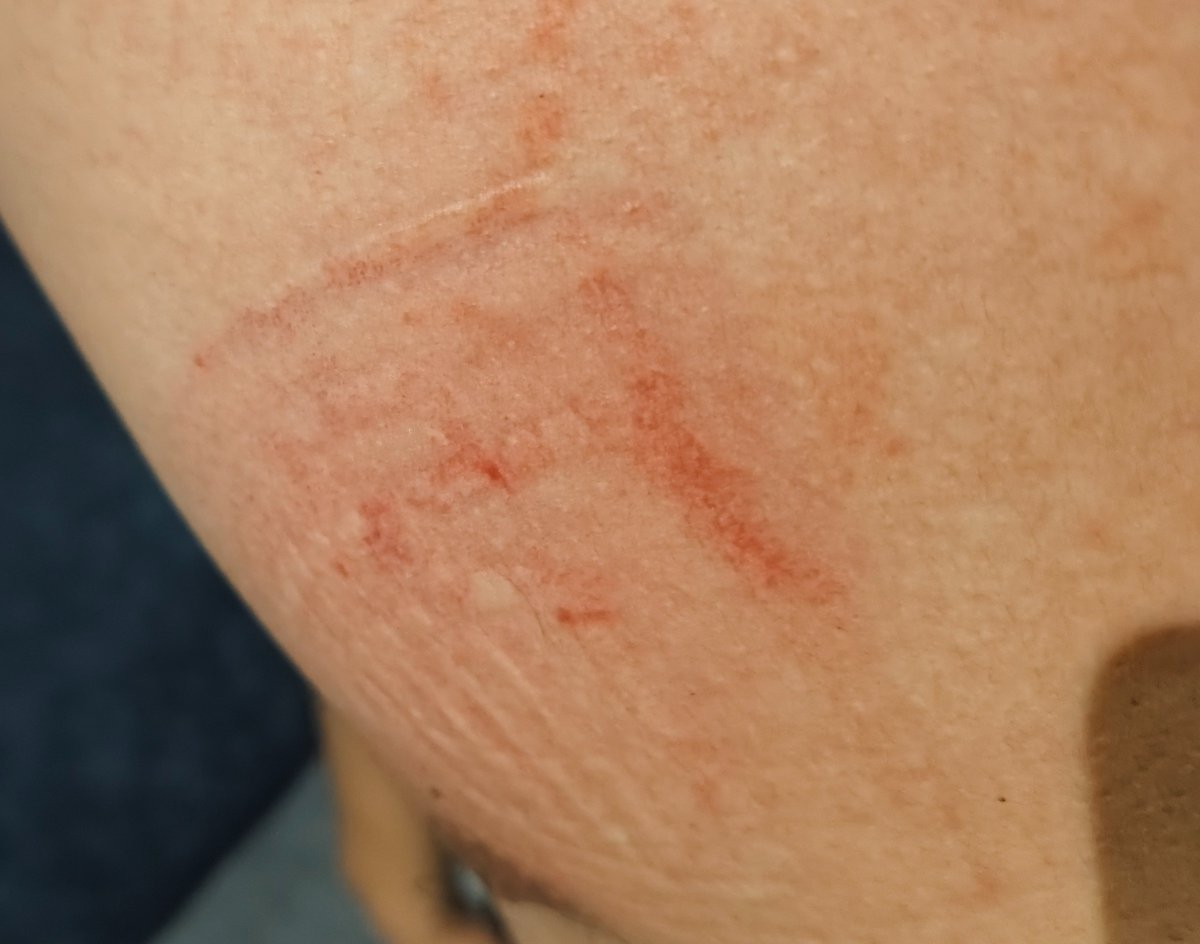 dm_suby's tweet image. 怎么皮肤上突然变得凹凸不平了😄而且印上了花纹

#男m #女s #踩踏 #恋足 #踩射 #鞋底 #上海 #调教 #现实 #女王 #踢裆 #乘骑 #舔鞋 #狗奴 #鞋印