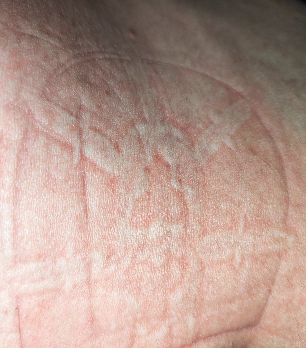 dm_suby's tweet image. 怎么皮肤上突然变得凹凸不平了😄而且印上了花纹

#男m #女s #踩踏 #恋足 #踩射 #鞋底 #上海 #调教 #现实 #女王 #踢裆 #乘骑 #舔鞋 #狗奴 #鞋印