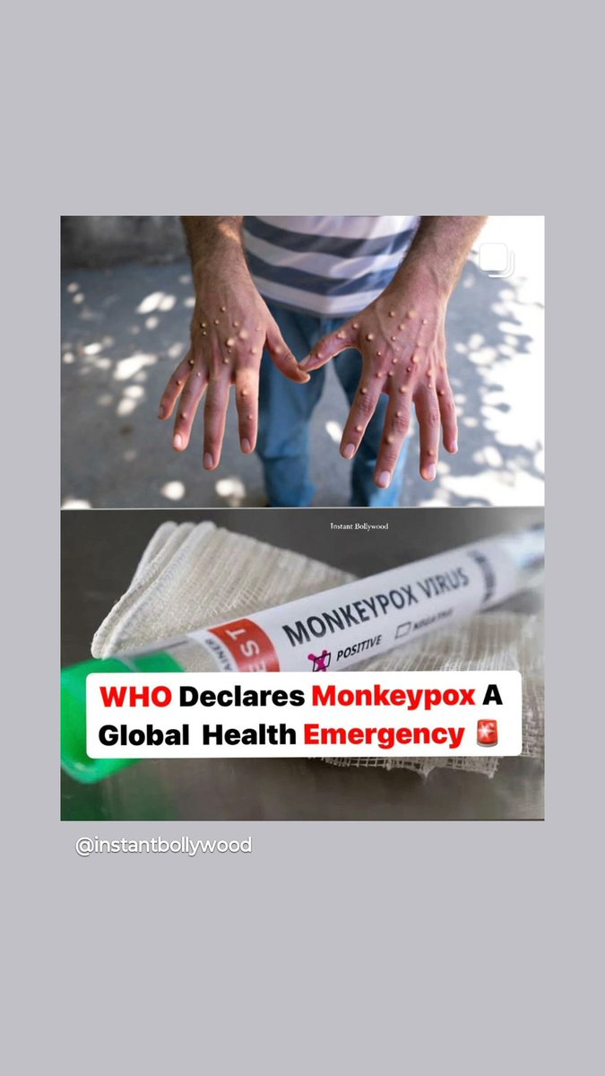 Ankit_singh0's tweet photo. WHO Director-General Dr Tedros Adhanom Ghebreyesus has determined that the upsurge of mpox in the Democratic Republic of the Congo (DRC) and a growing number of countries in Africa constitutes a public health emergency of international concern (PHEIC) 
#WHO
#pandemic
#monkeypox https://t.co/CIAlnGYxn8