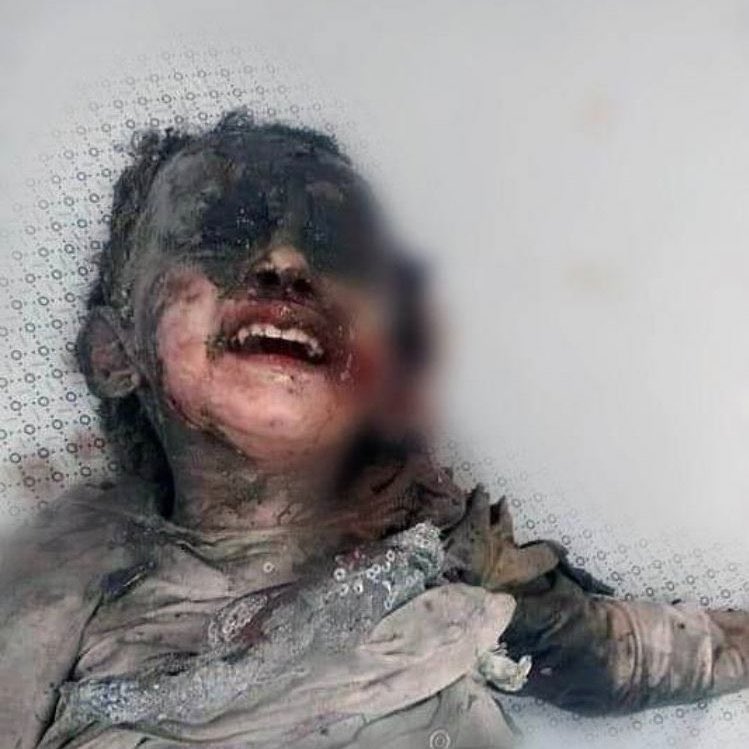 لا أعتذر لقساوة المشهد ويجب أن يشاهده كل العالم