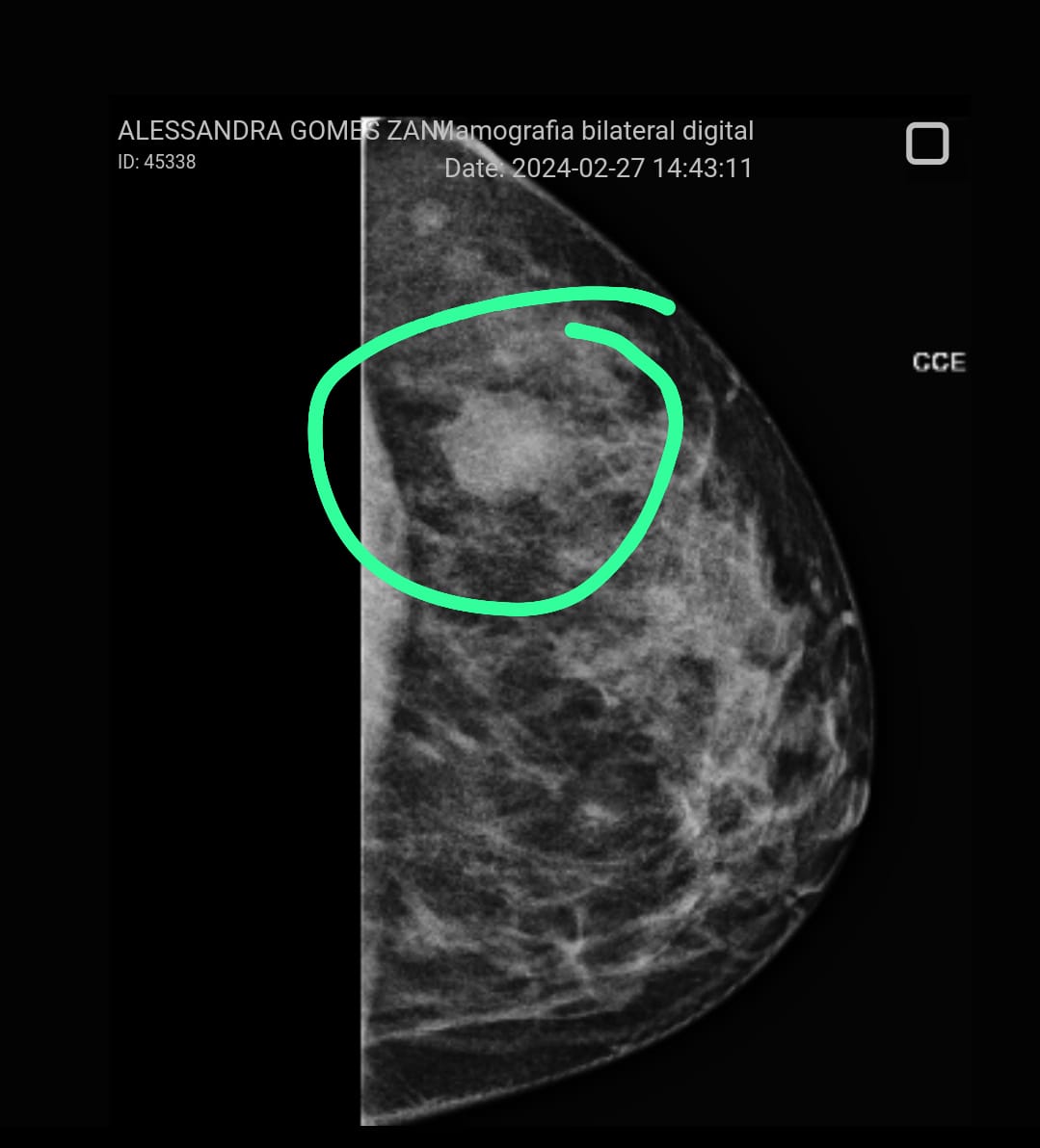 Bom dia, preciso da ajuda de vocês na minha vakinha, estou tratando um câncer de mama, qualquer ajuda é abecoada. Agradeço muito.
Pix alezani51@gmail.com