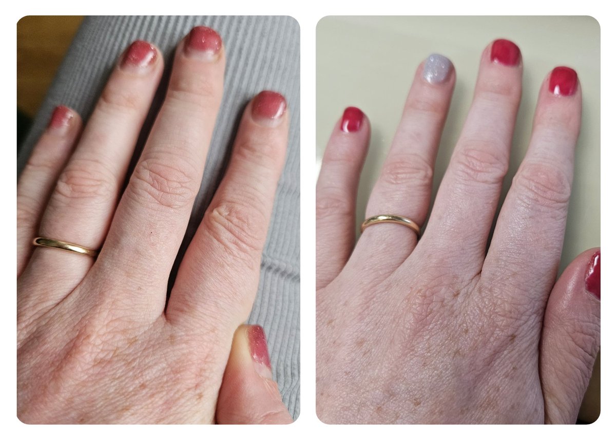 shiftms's tweet photo. Self-care Saturday always means a gym sessions, hair appointment and some weeks the nails get done.
What do you do for self-care. For your mental health
#livingwithppms #livingwithms #ppmsandme #ppmsdiagnosis #primaryprogressivems #ppmsiswhatihave #unashamedlychelle https://t.co/ArU2L4Y6dn