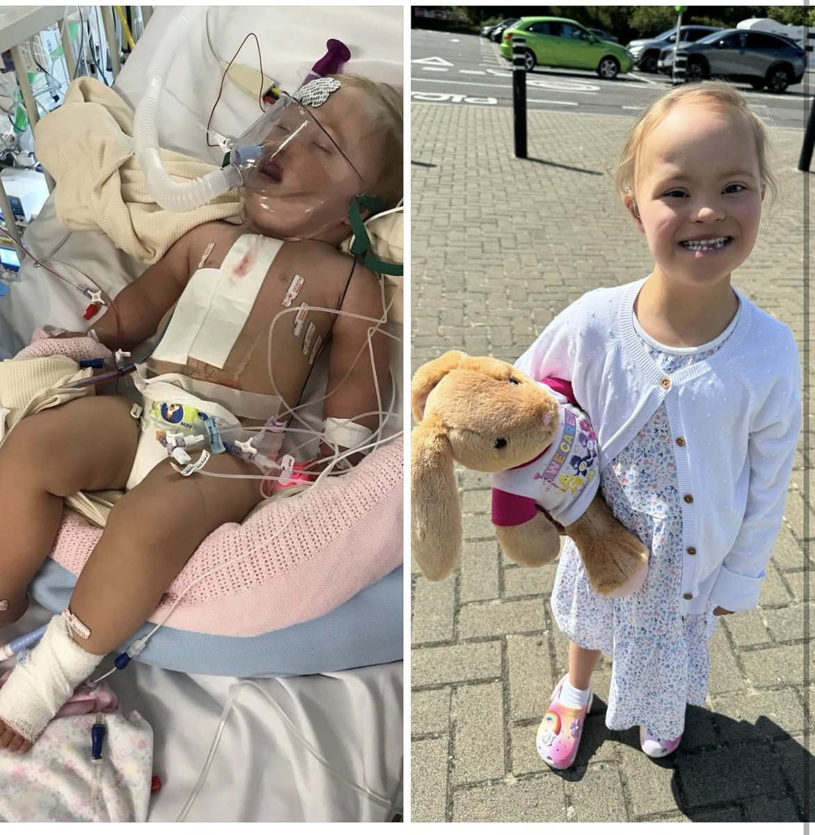 6 years ago today… and now! So proud of this little girl every single day. My warrior, my inspiration. ❤️