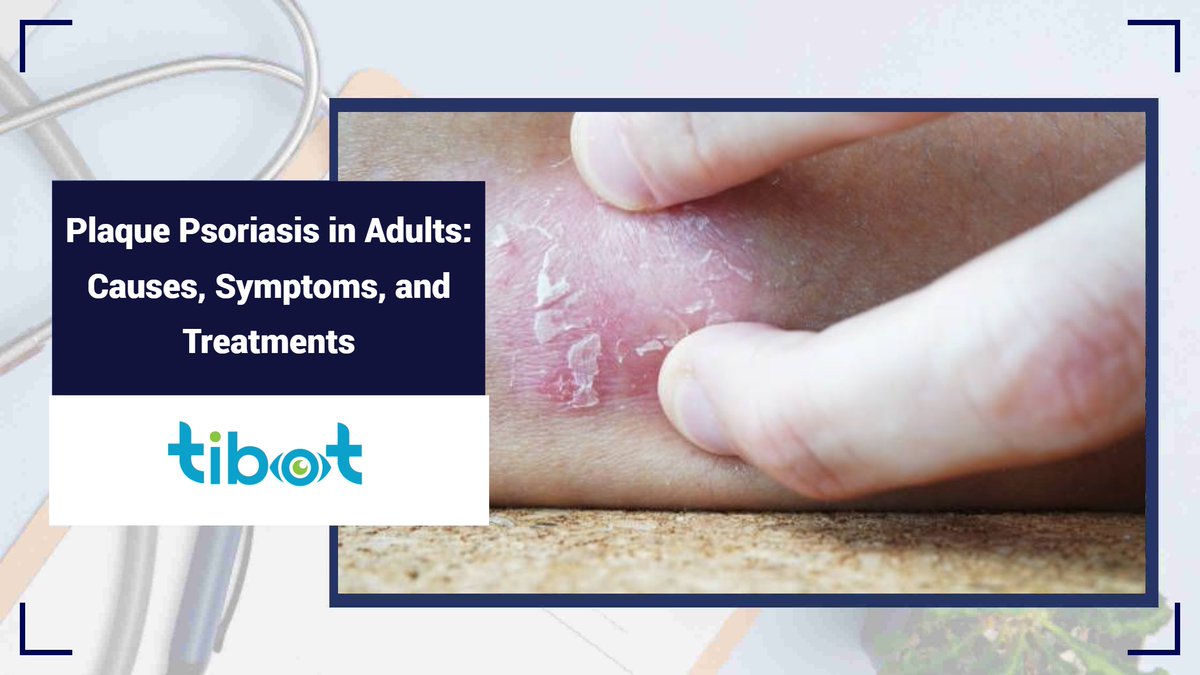 tibot_ai's tweet photo. Discover Everything About Plaque Psoriasis in Adults! Struggling with Plaque #Psoriasis or know someone who is? Learn more: https://t.co/KMR2U2GzzI about this common condition and how to manage it effectively. 

#PlaquePsoriasis #SkinHealth #PsoriasisAwareness #LoveNextDoor https://t.co/kMqKEgJ6GZ