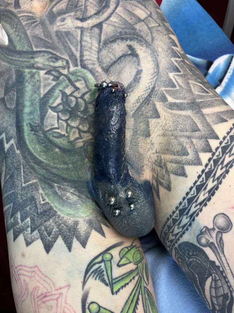 Keresek urológust aki nagyon megvizsgálna, #urológus #bdsm #male #orvos #cbt