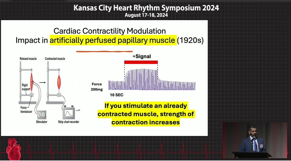 Role of Cardiac Contractility and Vagal Nerve Stimulation in Managing Patients with Heart Failure Dr. Rizwan Afzal #KCHRS24