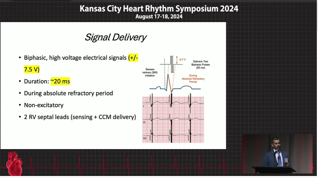 Role of Cardiac Contractility and Vagal Nerve Stimulation in Managing Patients with Heart Failure Dr. Rizwan Afzal #KCHRS24