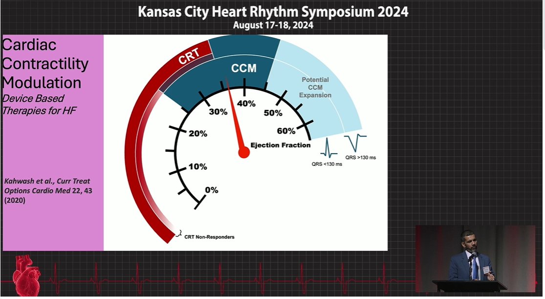 Role of Cardiac Contractility and Vagal Nerve Stimulation in Managing Patients with Heart Failure Dr. Rizwan Afzal #KCHRS24
