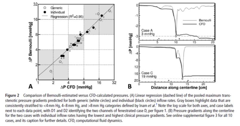 JNIS_BMJ's tweet photo. Who remembers their physics?  Sidora, Steinmen, et al certainly do as they demonstrate Bernoulli's formula can predict trans-stenotic pressure gradients in venous sinus stenosis. https://t.co/DrTPeoVdbh #IIH https://t.co/3mD08Hmd5S
