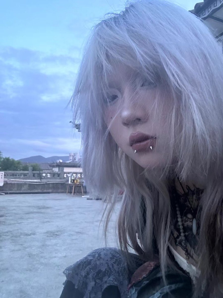 伍老师的穿刺技术什么水平就不多说了DDDD