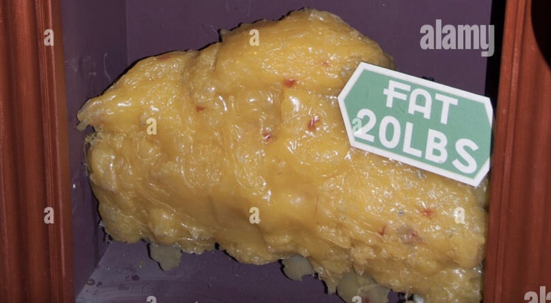 You can lose 20lbs of fat in 8 weeks:

- Without starving
- Without aggressive dieting
- And without living in the gym

20lbs makes a MASSIVE difference in your physique and energy

Here's how to do it starting today:

#1 - Fasted cardio 2-3x per week.