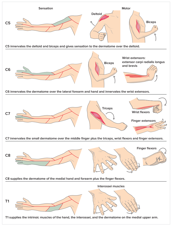 NeuroWalid's tweet photo. Cervical radiculopathy and associated exam: 
#neurotip #neuromuscular https://t.co/zipweYY1Ht