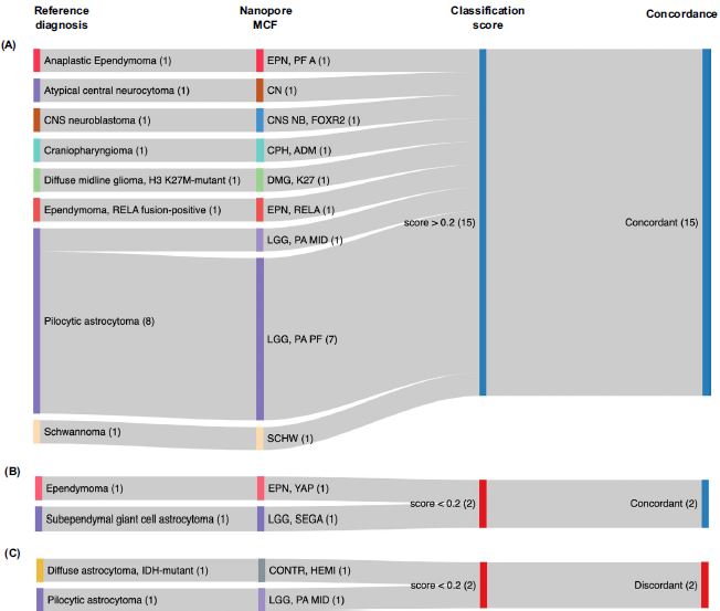 JNeurooncol's tweet photo. Simon et al from @ChariteBerlin. Methylation-based classification of pediatric CNS tumors based on ultrasonic aspirator-reduced tissue is feasible using time- and cost-efficient @nanopore sequencing. https://t.co/QdOUeDsTtQ https://t.co/Vp060gBCQY