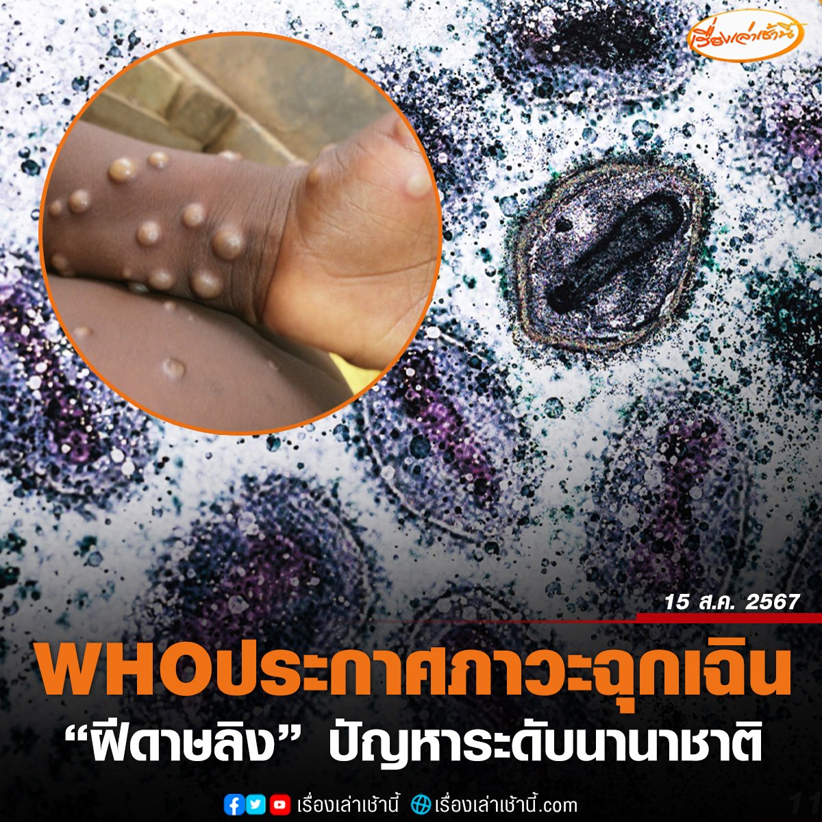 ทำไมไม่เห็น สธ. ไทยออกมาพูดถึงเรื่องนี้เลย เงียบมากขขาวรอบนี้ดังมาเป็นอาทิตย์แล้วนะ ทำไรกันอยู่?????