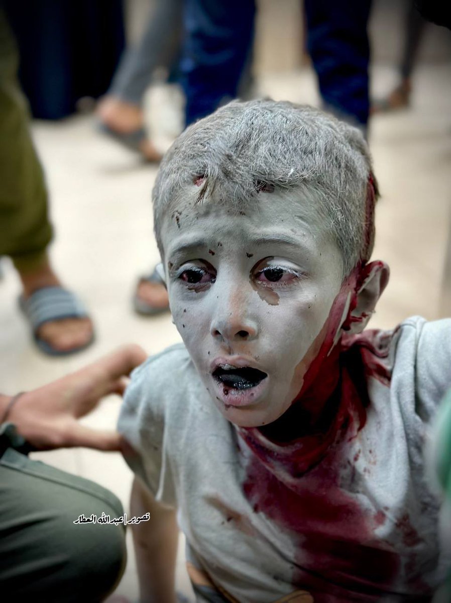 IN ORDER TO SAVE YOUR CHILDREN, YOUR FUTURE, LIVES AND YOUR HOME AND HOMELAND, BANN ISRAELI TERRORSTS FROM YOUR COUNTRY.
RAISE YOUR VOICE,
TAKE ACTION FOR GAZA🇵🇸,
SUPPORT FREE PALESTINE🇵🇸,
BANN&amp;BOYCOTT TERRORIST ISRAEL ⛔☢️
#SupportFreePalestine
#SaveGaza
#BoycottTerroristIsrael