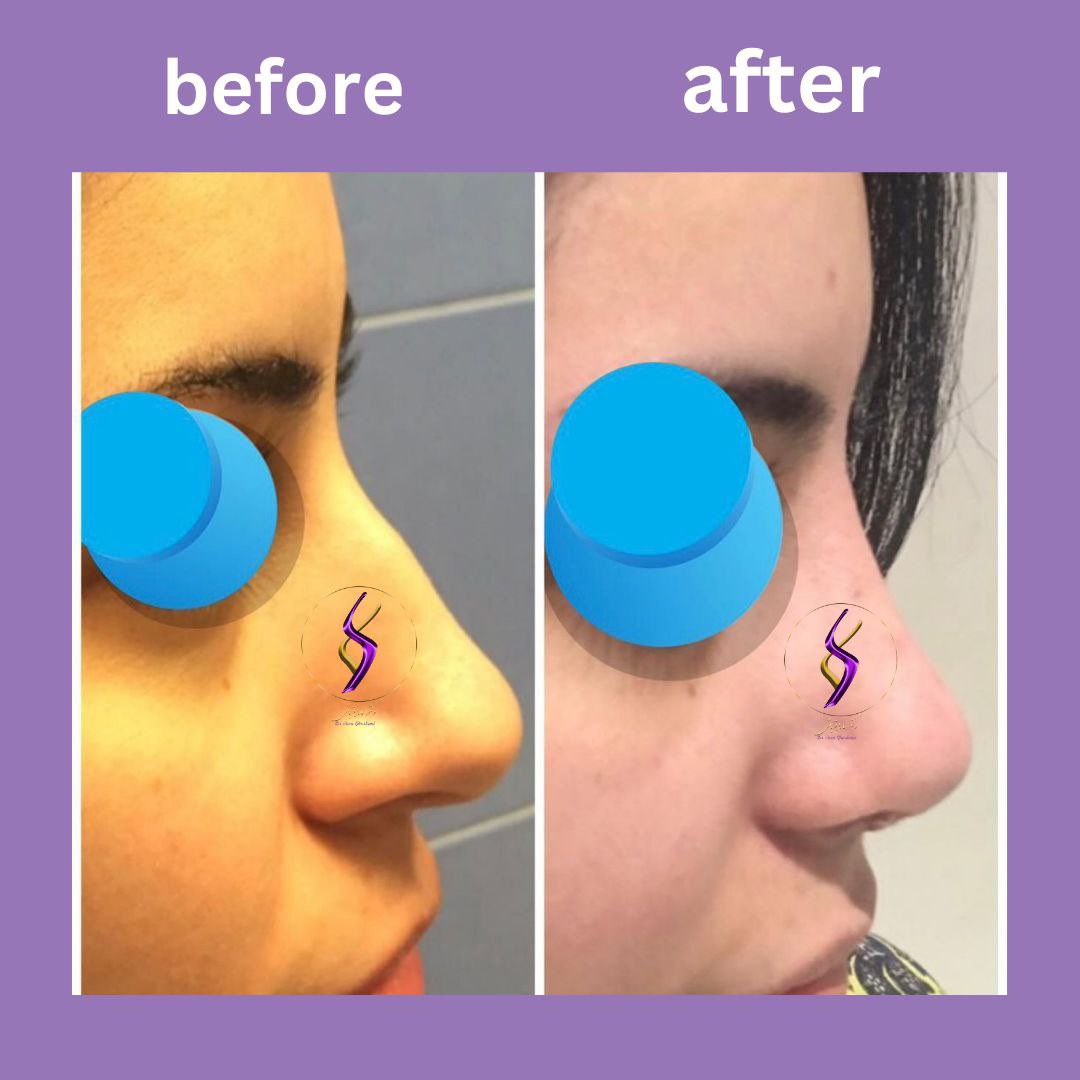 Dr.Sara Ghorbani tweet media