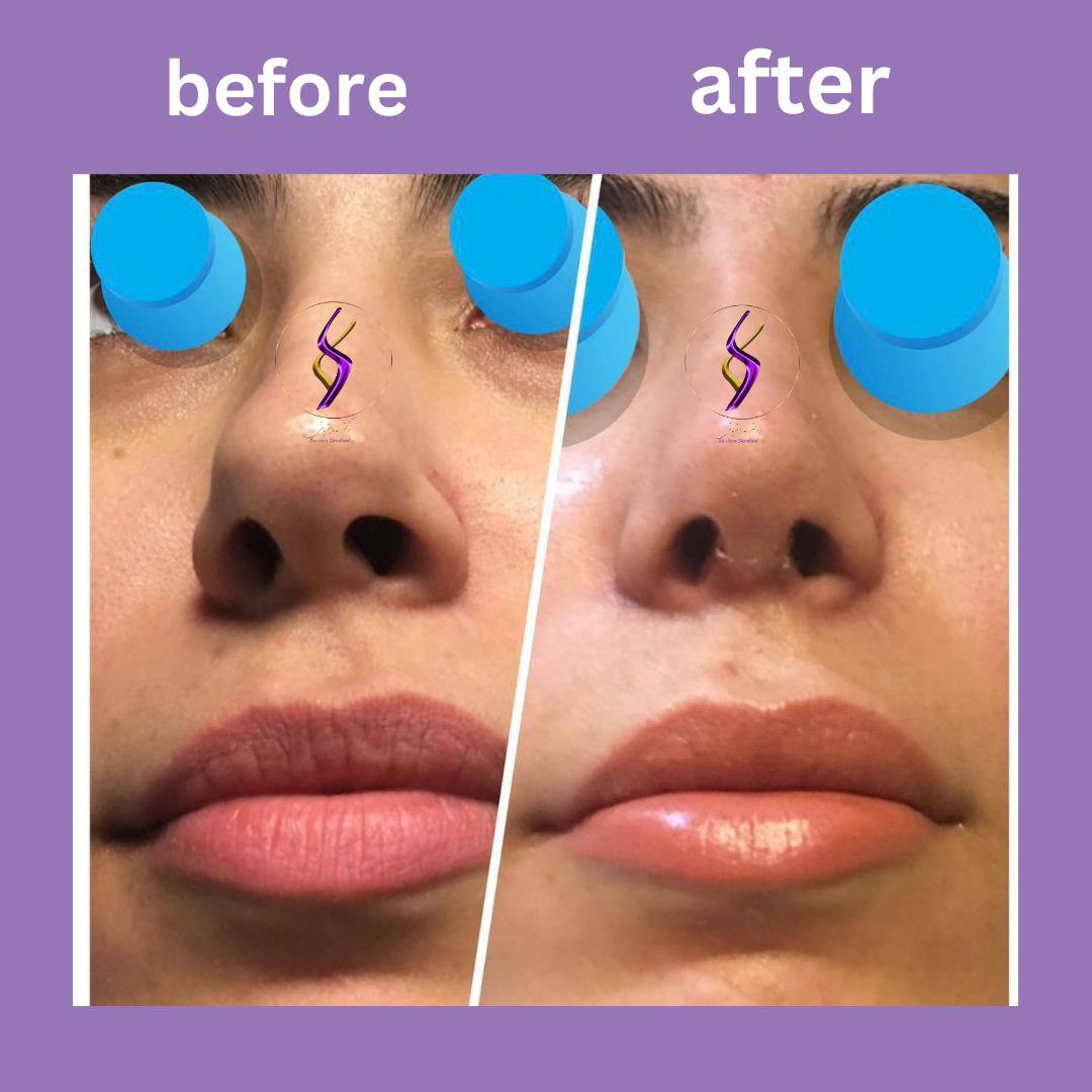 Dr.Sara Ghorbani tweet media