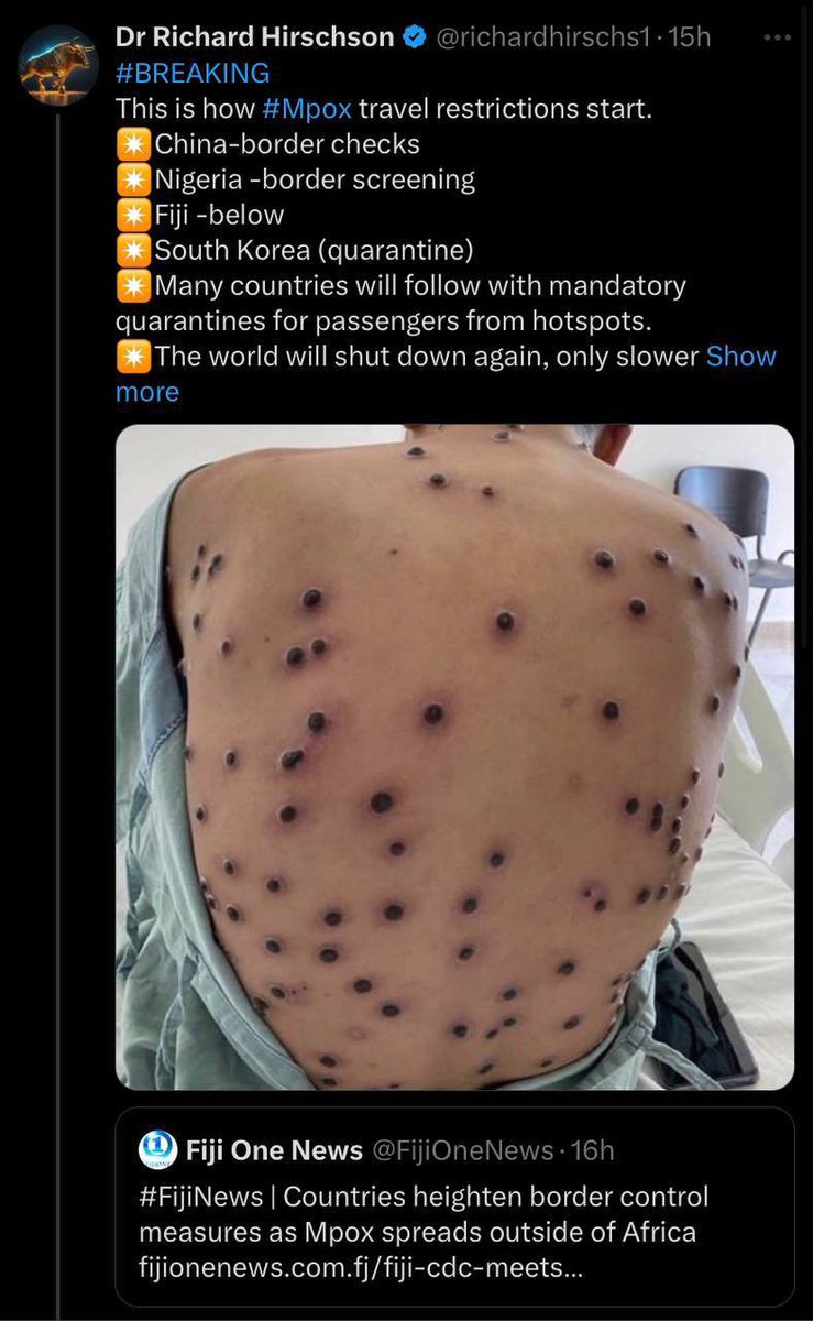 Jo_Ve's tweet photo. Money pox is serious!! Get $poxke to avoid this!!! 🦠

CA: FRmySqvKu17yuj8HuppukAGnhQbngWpyjFjo2zkqpump https://t.co/QtwTT5KBu3