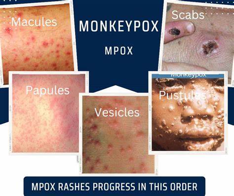 REPONGAC tweet media