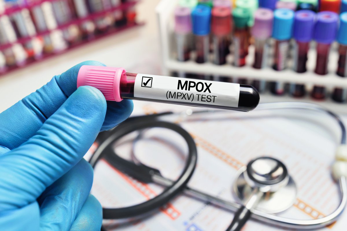 sormas's tweet photo. Did you know that #SORMAS has a specific #Mpox  module? The module allows case-based data entry, contact-tracing, collection of main patient data and samples and it's linked to the #immunization module. This allows the efficient and timely management and control of #outbreaks! https://t.co/faewZouh4k
