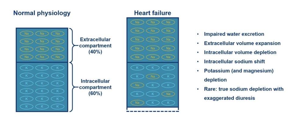 LeslieMegom's tweet photo. ⚖️🧂Evaluación y manejo de la hiponatremia en la insuficiencia cardíaca.🫀
🧂Hponatremia grave se define por niveles séricos de sodio <125 mEq/L.
🧂⤵️ hiponatremia aguda ( <48h)
🧵👇 https://t.co/mdniOzs1M9