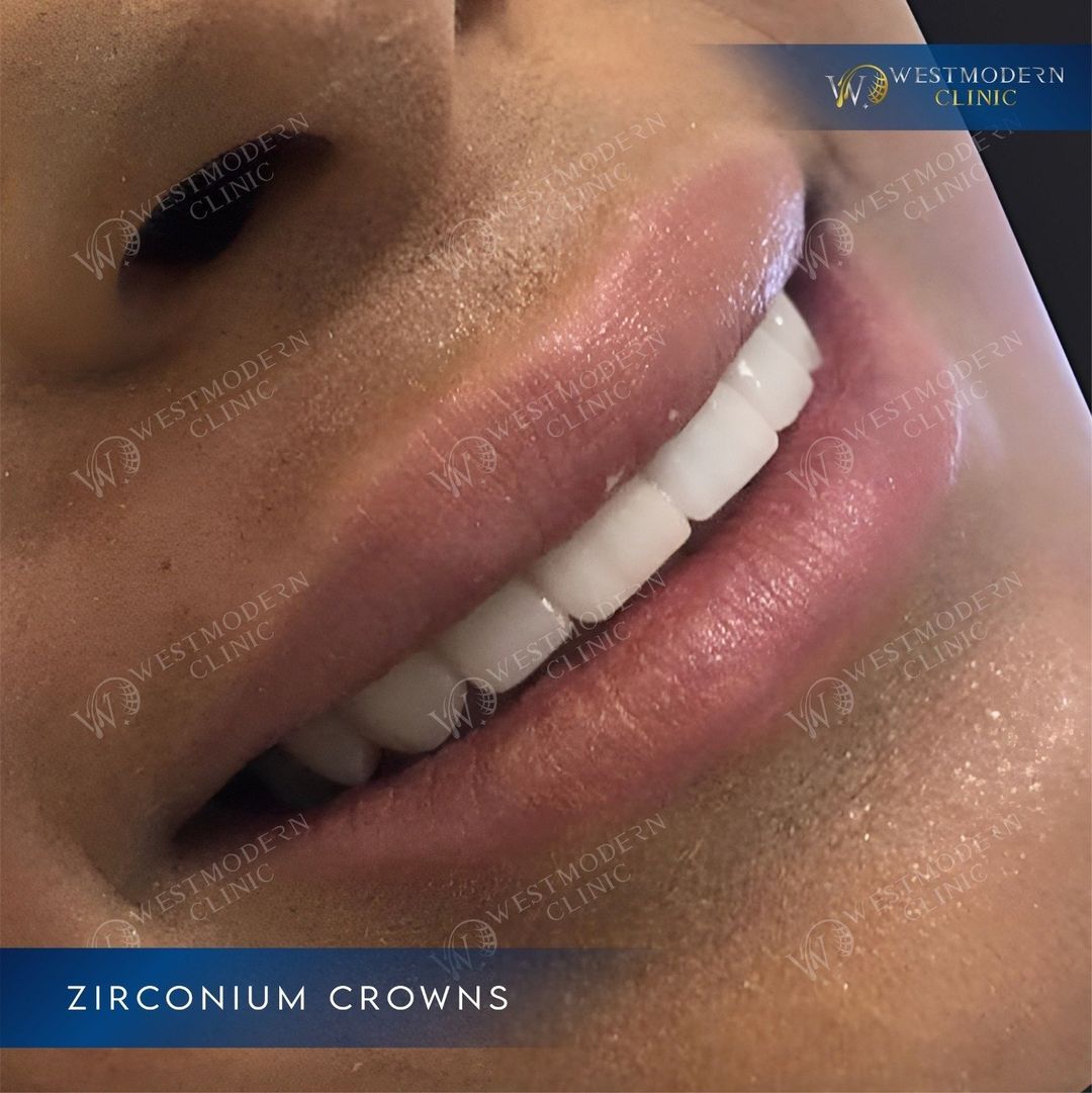 WestModernTR's tweet photo. WestModern Clinic: Where advanced technology meets exceptional dental care. Visit us in Istanbul! https://t.co/psCdFXN0CQ