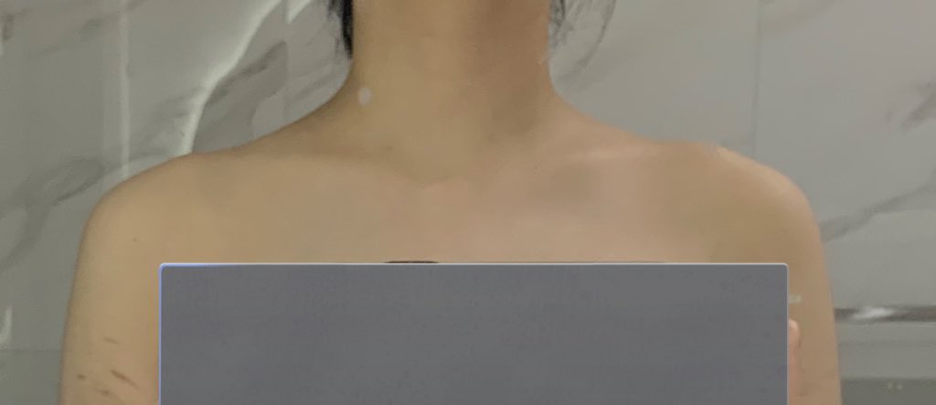 pia_aa0's tweet photo. 자세 교정한다고 내 어깨가 이뻐지겠냐라고 생각했던 사람 진짜 0.1초만에 저렇게 됨 자세교정은 꼭 하시길 https://t.co/51yMPP2N9b