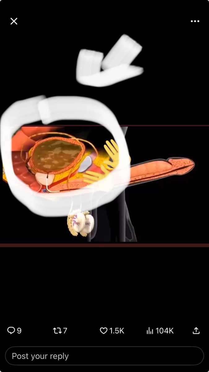 RoxyRoyal15's tweet photo. @chxinzsaw @grlskissr @hiperortivo Are you serious?! 😂 pls for the sake of humanity tell me no https://t.co/ojjYer293P