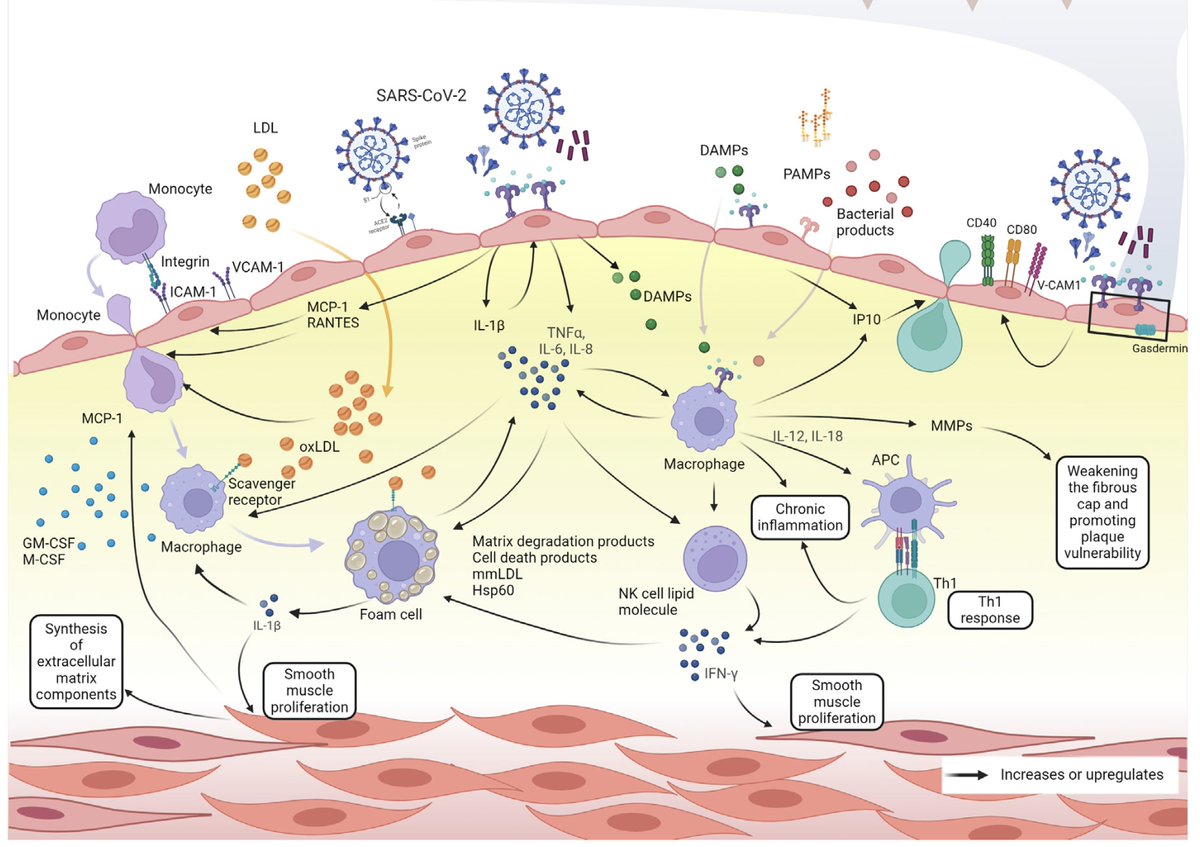 Eric Topol (@erictopol) on Twitter photo An open-access, in depth review for how #SARSCoV2 can induce platelet activation, endothelial dysfunction, pro-inflammatory effects, and promote progression of atherosclerosis #LongCovid sciencedirect.com/science/articl… h/t <a href="/CatchTheBaby/">Ruth Ann Crystal, MD</a> <a href="/JACCJournals/">JACC Journals</a> <a href="/vchidambaram91/">Vignesh Chidambaram MD, MPH</a> An open-access, in depth review for how #SARSCoV2 can induce platelet activation, endothelial dysfunction, pro-inflammatory effects, and promote progression of atherosclerosis #LongCovid sciencedirect.com/science/articl… h/t <a href="/CatchTheBaby/">Ruth Ann Crystal, MD</a> <a href="/JACCJournals/">JACC Journals</a> <a href="/vchidambaram91/">Vignesh Chidambaram MD, MPH</a>