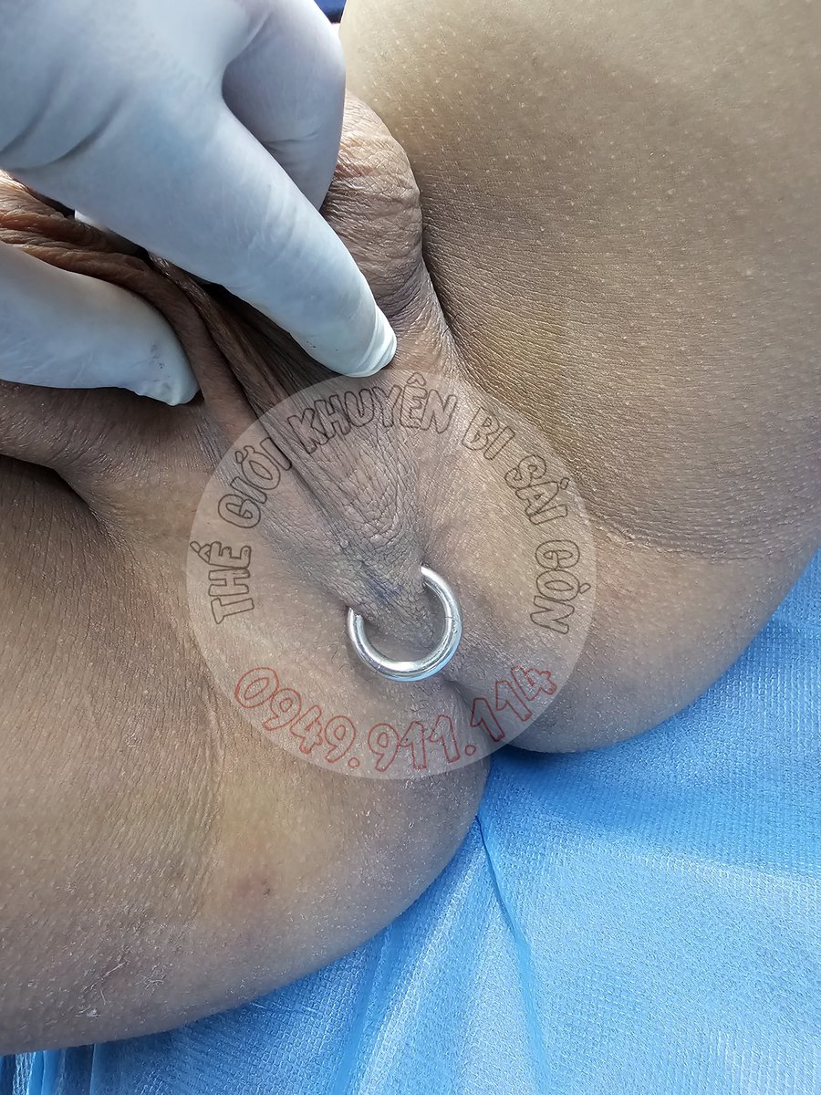 Gambisaigon's tweet photo. Tiếp vị khách giữa đêm🥰🥰🥰
Guiche 4mm
Scrotal 5mm

#guiche 
#Scrotal 
#hafada 
https://t.co/6Q6koG6i1q
https://t.co/MD30zLnzvW
https://t.co/NHLbuEfcsk https://t.co/Txkwo82d7o