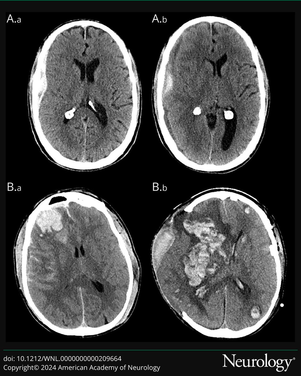 Neurology Journal tweet media