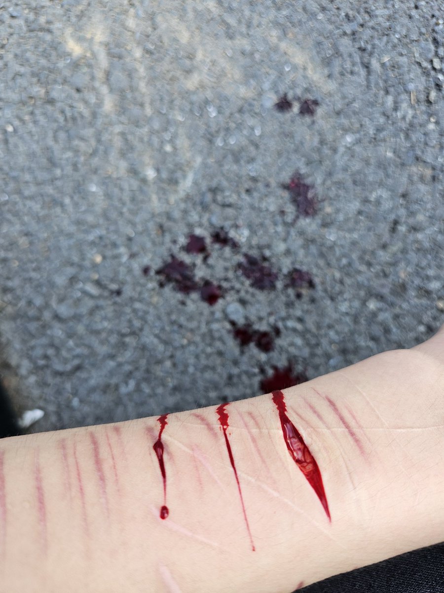 __yuujin__'s tweet photo. 미친 피가안멈춰
그렇게 쎄게 긋지도않았는데 피가 1분넘게 안멈춰
ㅋㅋㅋㅋㅌㅌㅌㅋㅌㅋㅋㅋ
#자해 #자해전시 https://t.co/nQCjEjqZV7