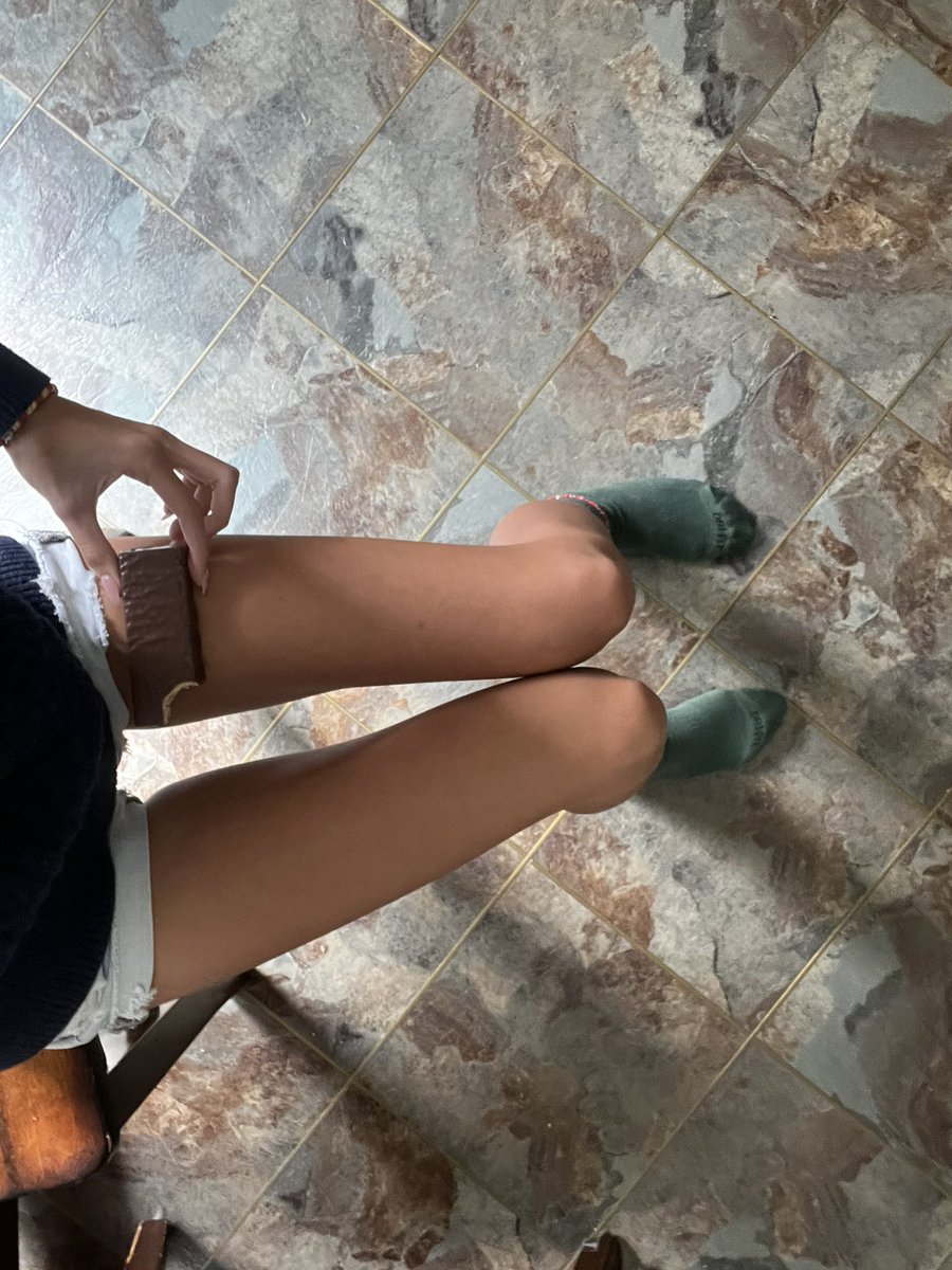 fawnscale's tweet photo. ignore the bite and how flabby my legs look but whatever :P https://t.co/8hBa9JjwuR