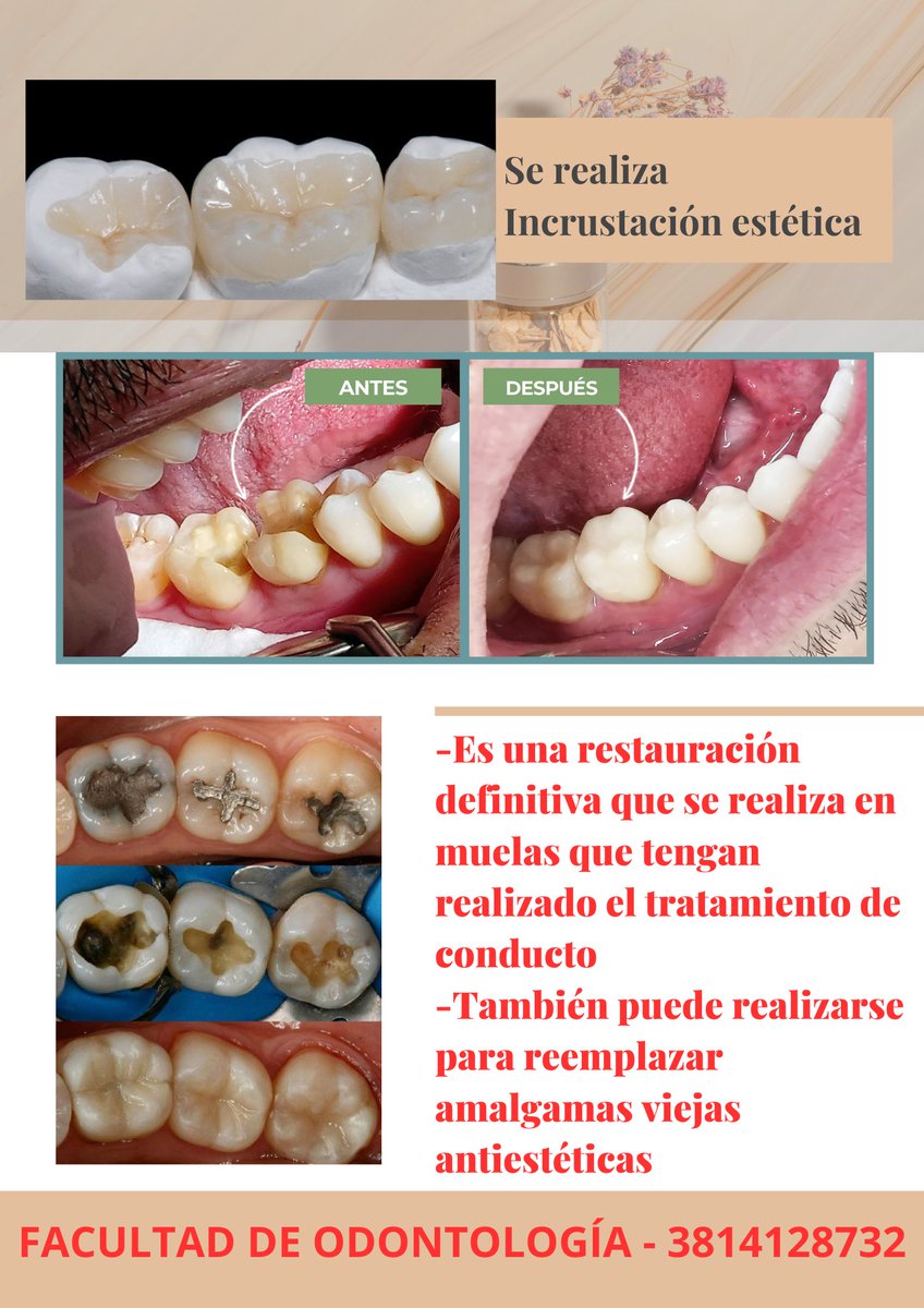 dologettas's tweet photo. INCRUSTACION DENTAL 
rt 🙏🏼🙏🏼🙏🏼🙏🏼 https://t.co/Gg2yoMvgiX