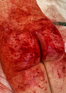 昔、女王様にボコられました。
よくM男さんが「ボコボコにされた」とか、「ハードプレイ」ってポストされてますが、これが本当のハードプレイだよ！

女王様・プレイがしたい方からのDMもお待ちしてます！
東京起点ですが全国出張可能です。
プレイ代無料！
ホテル代はこちらが負担しますよ。