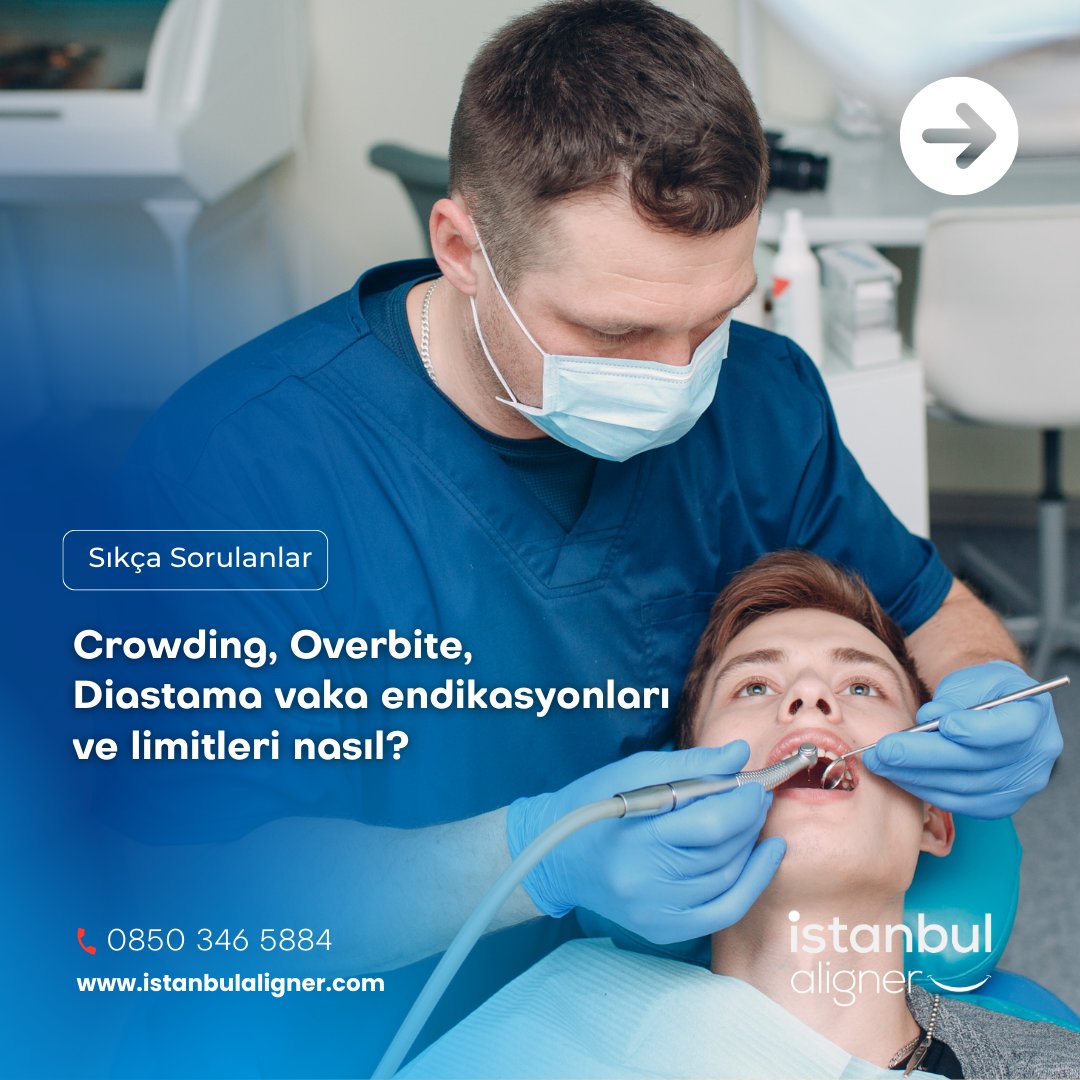 istanbulaligner's tweet image. İstanbul Aligner #Crowding, #Overbite, #Diastama vaka limitleri içerisinde mükemmel sonuçlar sunar.

📞 0 850 346 5884
🌐 istanbulaligner.com

#istanbulaligner #şeffafortodontiktedavi #şeffaftedavi #aligner#yeninesilteknoloji #şeffafgülüşler #diştedavisi